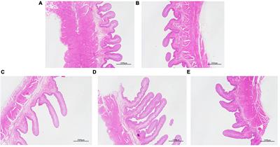 Changes in Rumen Bacterial Community Induced by the Dietary Physically Effective Neutral Detergent Fiber Levels in Goat Diets